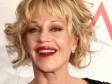 Melanie Griffith ima rak kože