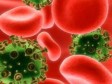 Novo istraživanje o početku pandemije HIV-a