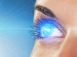 Što ako kihnem za vrijeme laserskog skidanja dioptrije?