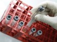 HIV povećava opasnost od srčanih bolesti 