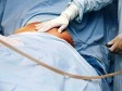 Liposukcija ima vrlo nezgodne nuspojave  