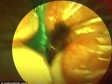 Video: Bivši zaposlenik snimio u McDonaldsu miša kako trčkara u vrećici punoj peciva