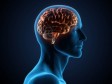 Otkriven lijek koji uvlike smanjuje simptome Alzheimerove bolesti