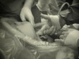 Video/Dirljivo: Beba iz majčine utrobe uhvatila doktora za prst